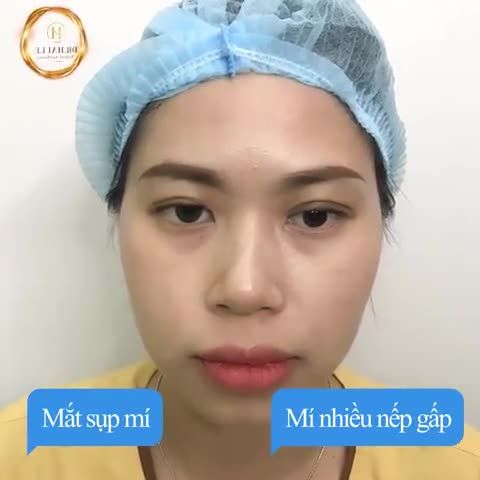 Ủa! alo đây có phải mắt một người không zợ! khác quá đi