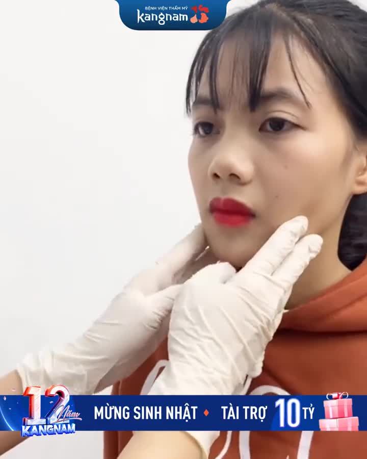 Cùng bác sĩ Annie tái khám cho khách hàng chỉnh hàm hô sau 1 tháng