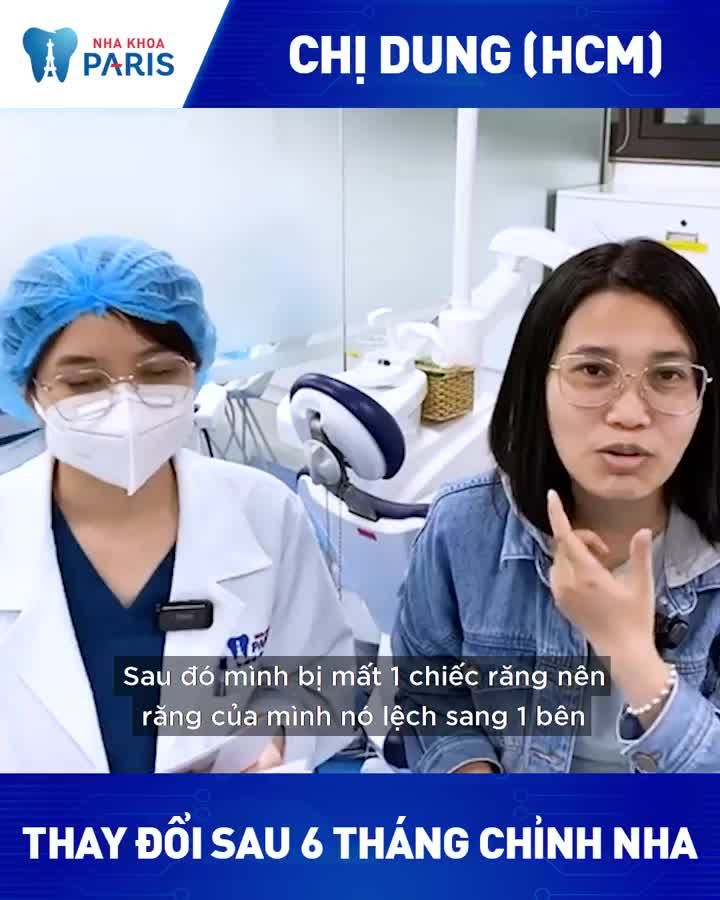 “Dạo này cười đẹp ra, mọi người khen mình quá trời luôn” Chia sẻ của chị Dung sau 6 tháng niềng