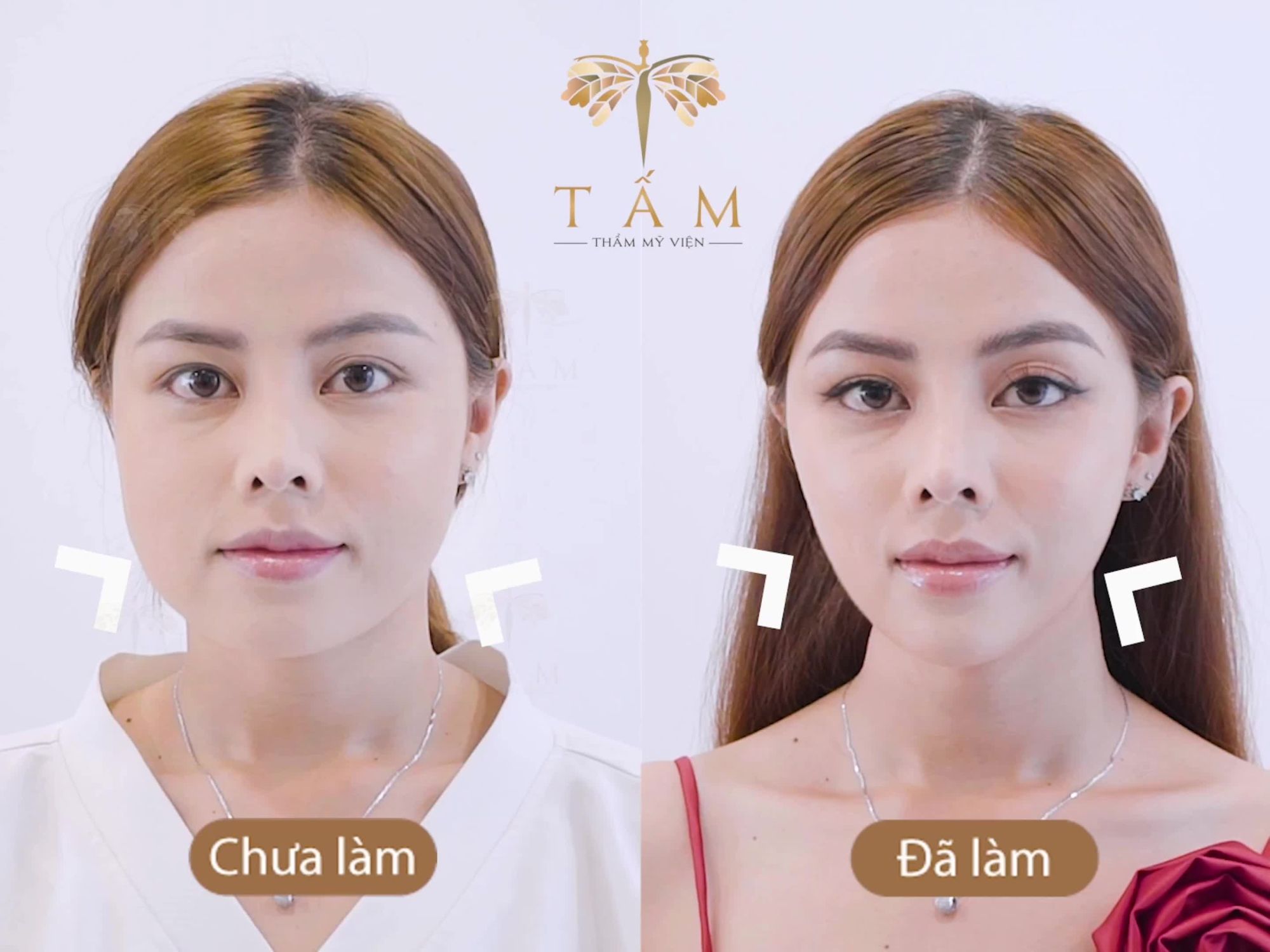 Sắp đến Tết rồi, bạn đã sẵn sàng tân trang nhan sắc chưa