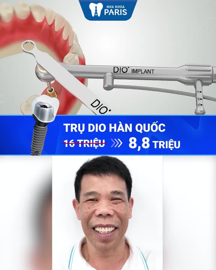 Trồng răng Implant - Ăn ngon kịp Tết