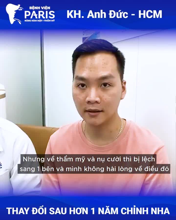 THỜI ĐIỂM NIỀNG RĂNG GIÁ TỐT