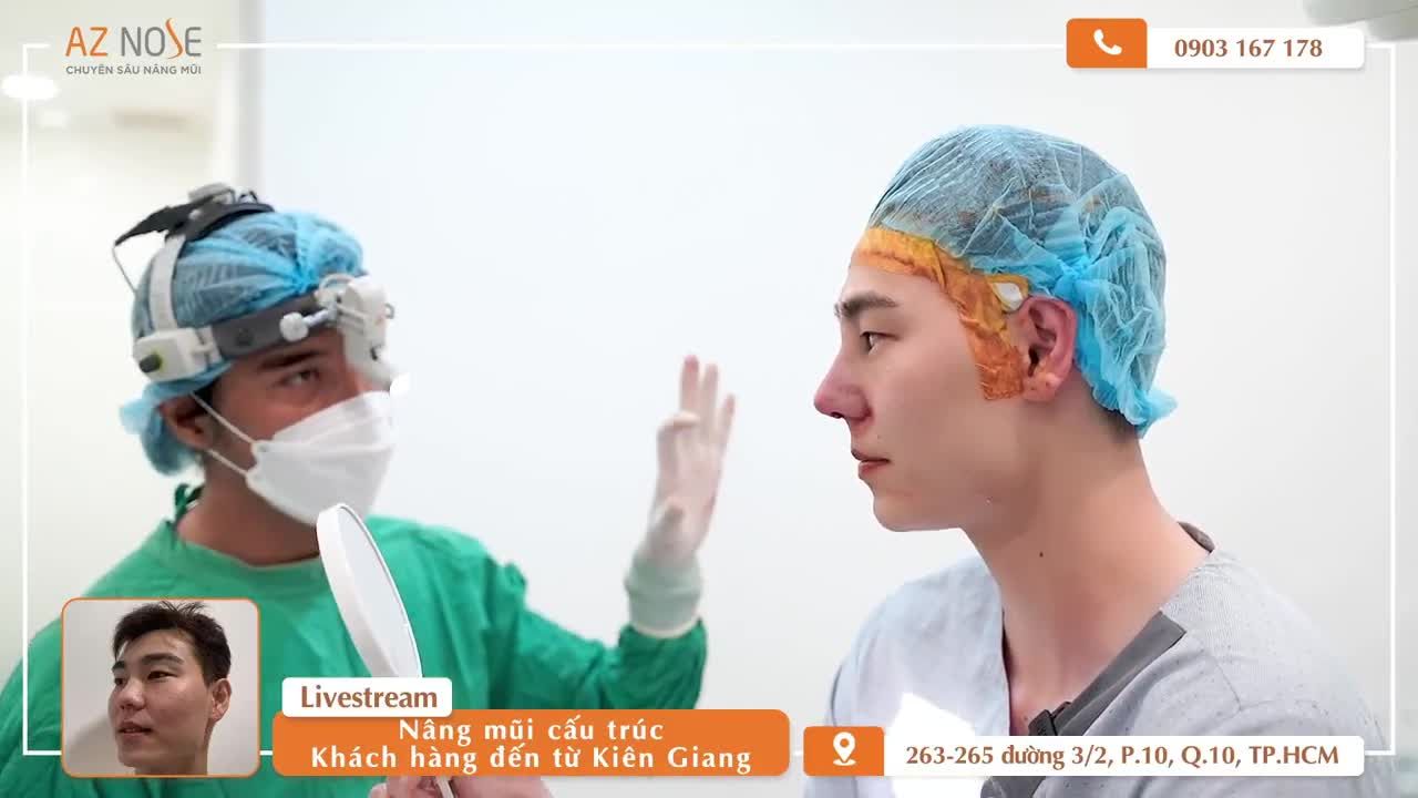 Dáng mũi nam tính của khách hàng đến từ Kiên Giang