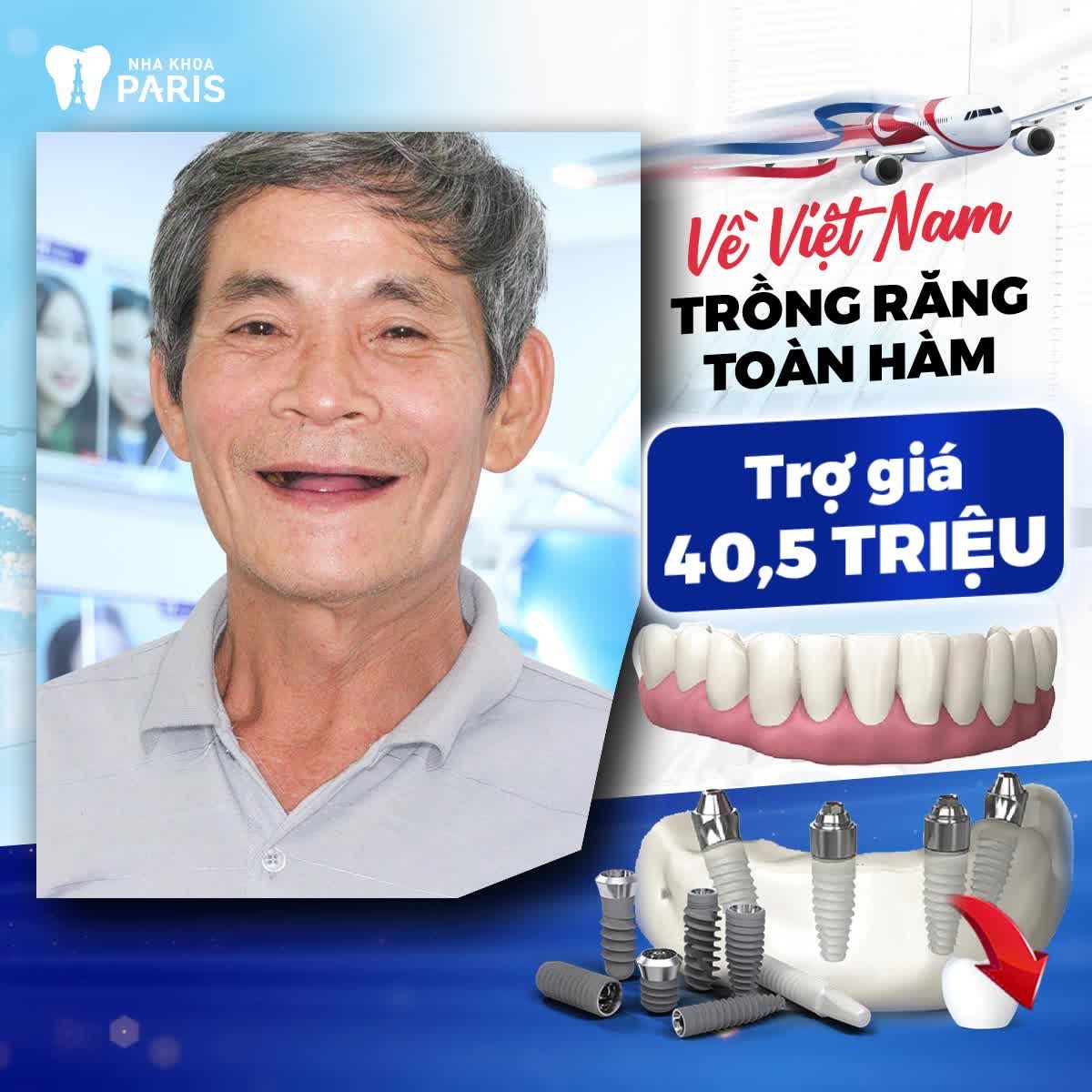 Về Việt Nam trồng răng chỉ 2 lần hẹn