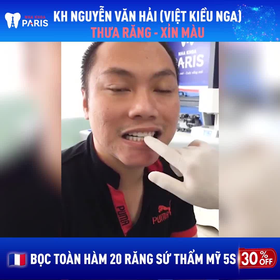 Bọc Sứ 20 Răng chỉ từ 3,5TRIỆU/răng