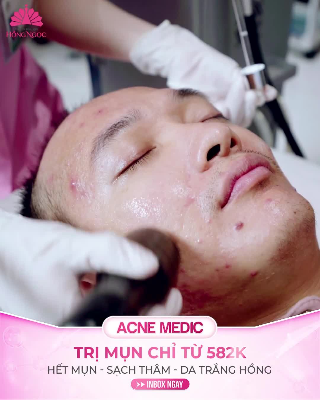 Mụn viêm sưng đỏ - Mụn mọc mất kiểm soát