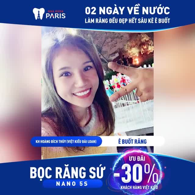 Kết Quả chị Hoàng Bích Thủy Bọc Sứ Toàn Hàm 20 răng Emax