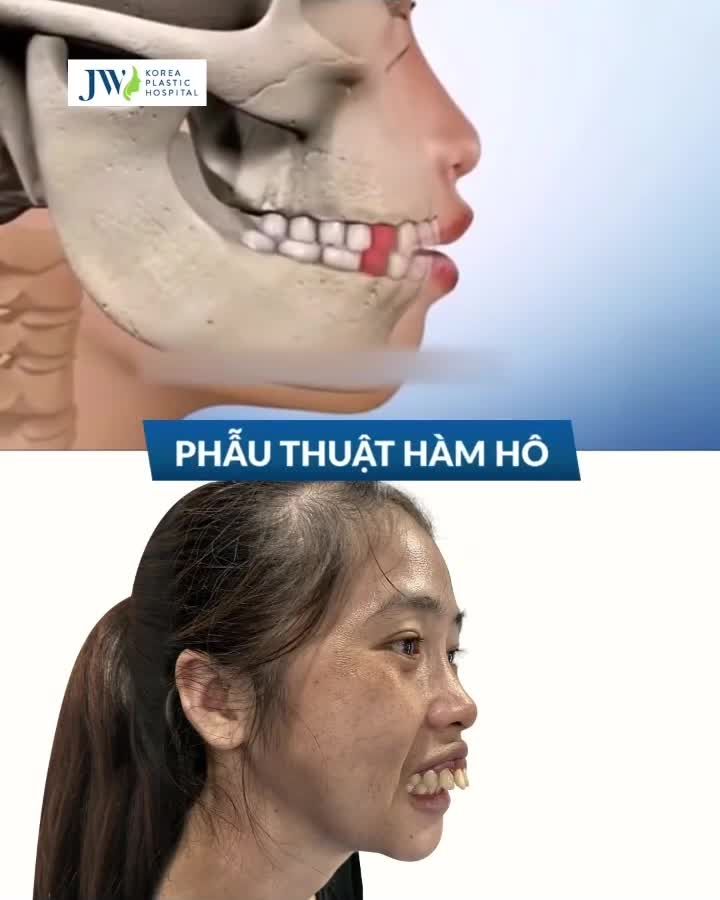THẨM MỸ HÀM MẶT - CHỮA LÀNH KHUYẾT ĐIỂM - THAY ĐỔI CUỘC ĐỜI