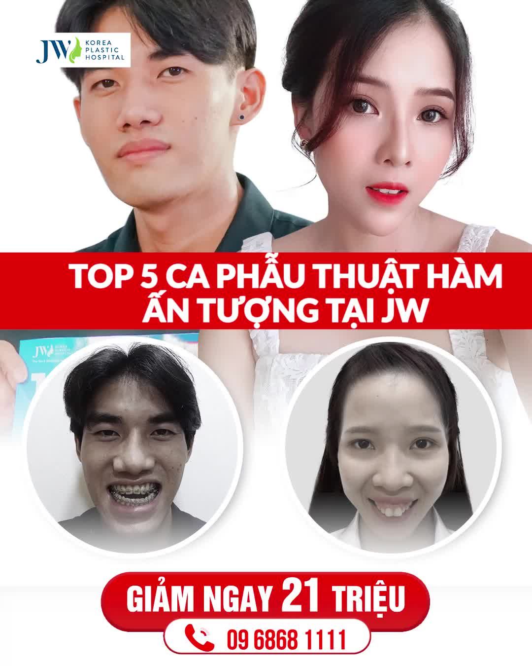 PHẪU THUẬT HÀM - NHAN SẮC MỚI, KHỞI ĐẦU MỚI