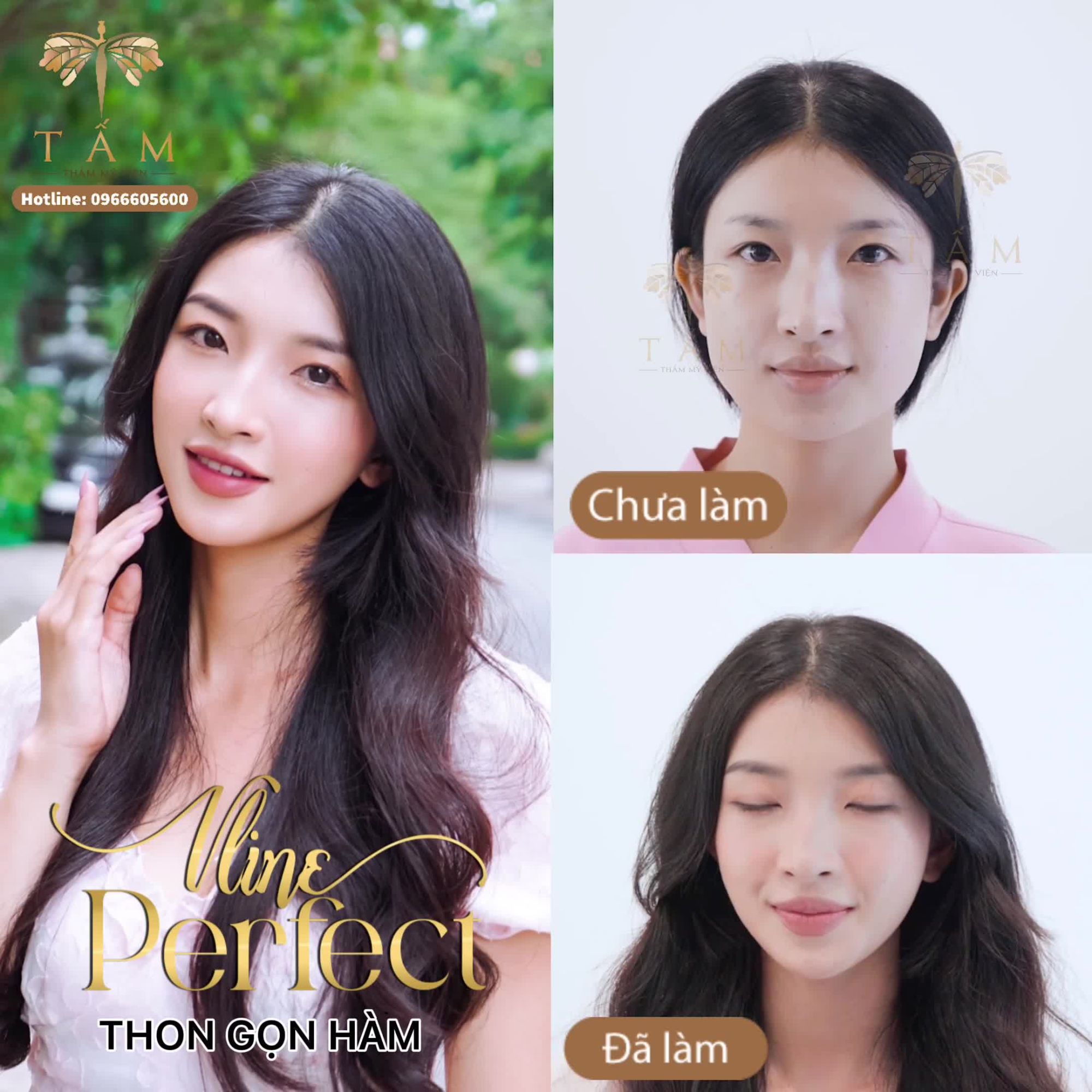“ĐIỀU KHIẾN MÌNH TỰ TI NHẤT LÀ PHẦN HÀM QUÁ TO, BẠNH VÀ THÔ