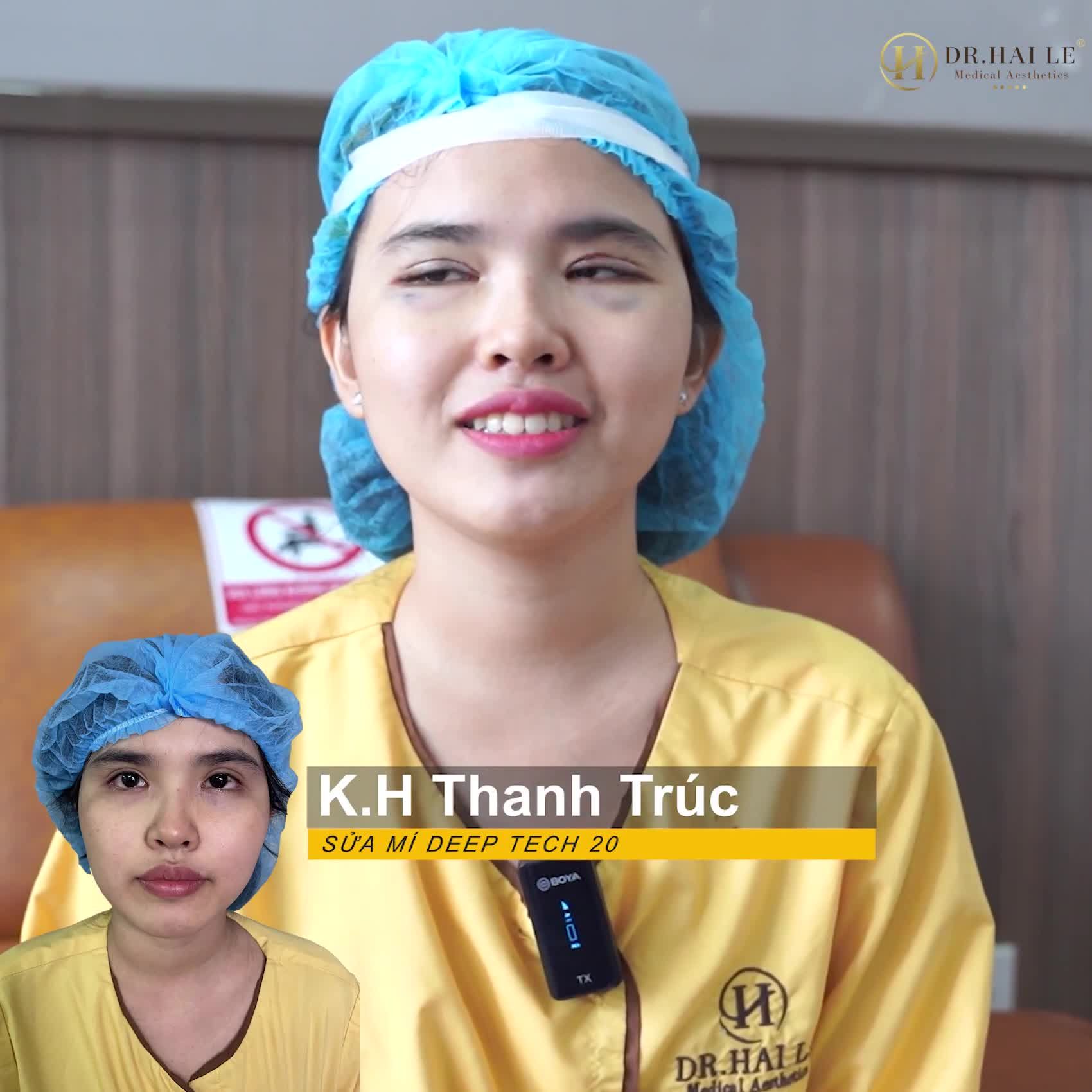 Từ khi cắt mí hỏng tại cơ sở thẩm mỹ khác ngày nào em cũng xem livestream của Dr.Hải Lê