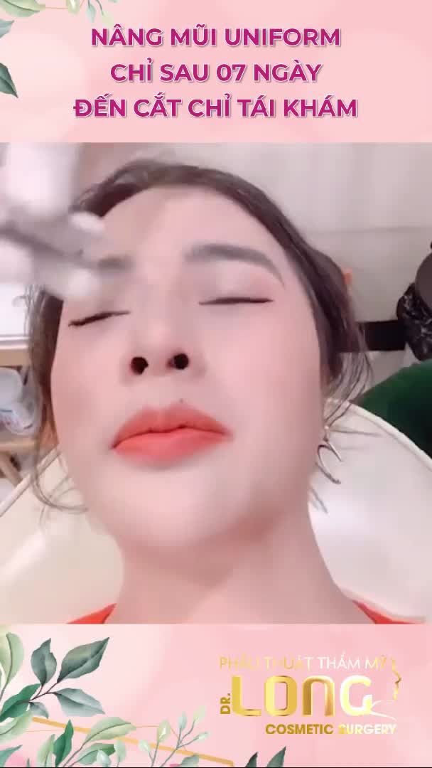 KHÁCH HÀNG SAU 7 NGÀY NÂNG MŨI