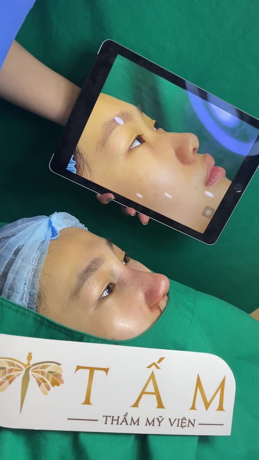 Cận cảnh ca nâng mũi Tái cấu trúc Reform của đội ngũ bác sĩ chuyên khoa nhà Tấm thực hiện, khác biệt hoàn toàn đúng không cả nhà!