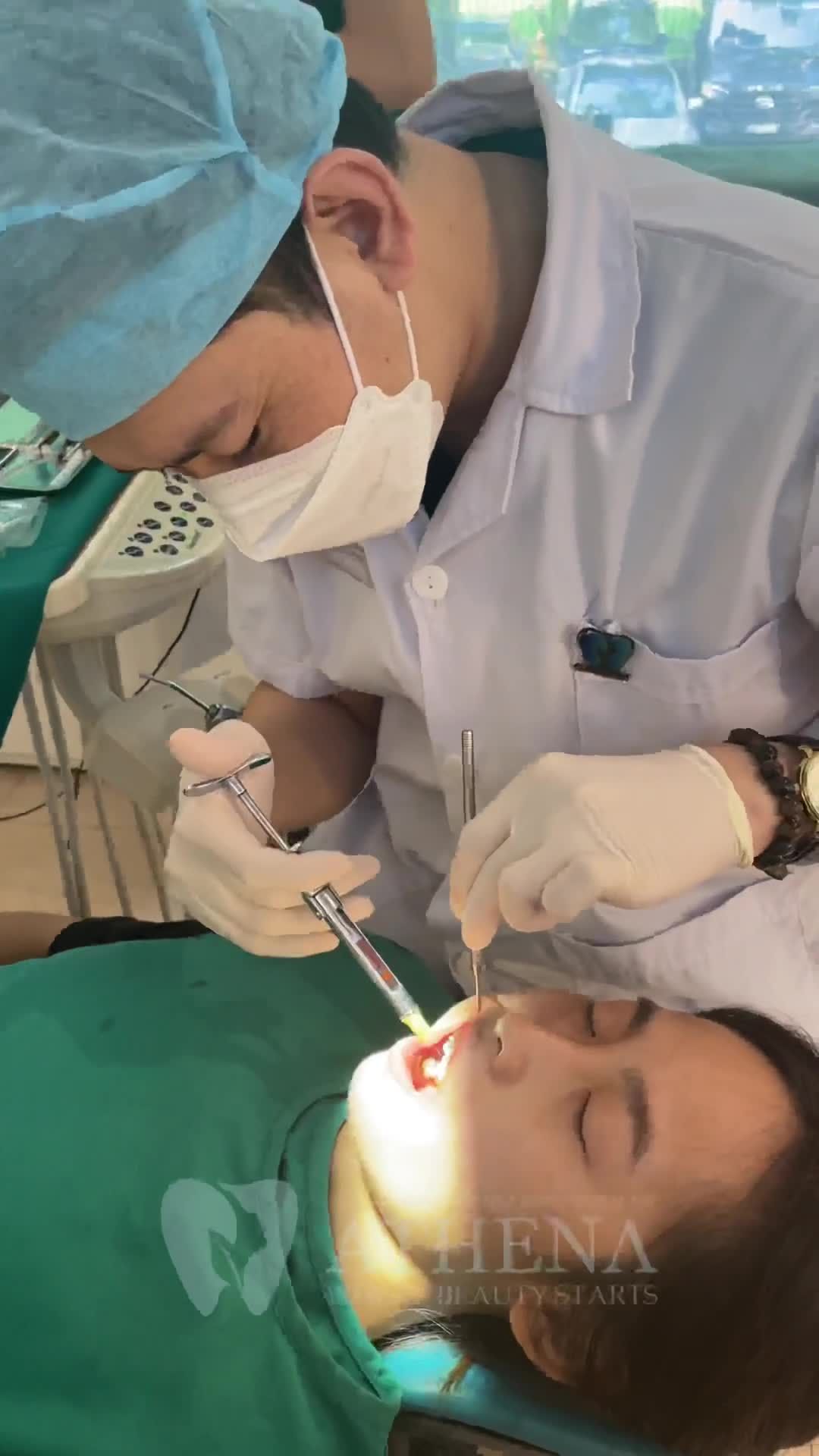 CẮM VÍT NIỀNG RĂNG CÓ ĐAU NHƯ LỜI ĐỒN