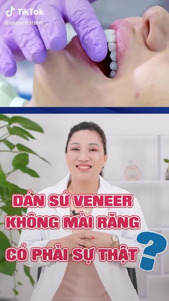 DÁN SỨ VENEER KHÔNG MÀI RĂNG CÓ PHẢI SỰ THẬT