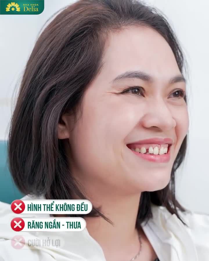 Giờ đây, chị có thể thoải mái cười mà không phải gượng gạo như trước.