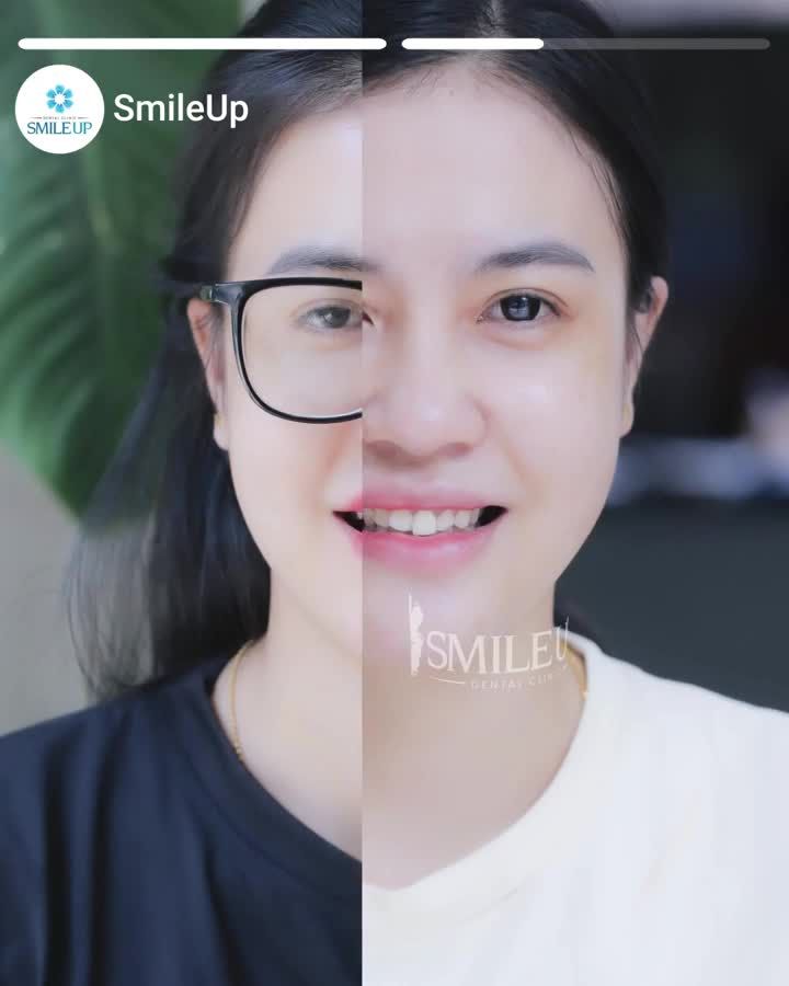 HÀNH TRÌNH LÀM ĐẸP ÊM ÁI, NHẸ NHÀNG - NỮ KHÁCH HÀNG TỰ TIN ĐÓN NỤ CƯỜI MỚI ĐẸP TRÊN CẢ KỲ VỌNG.