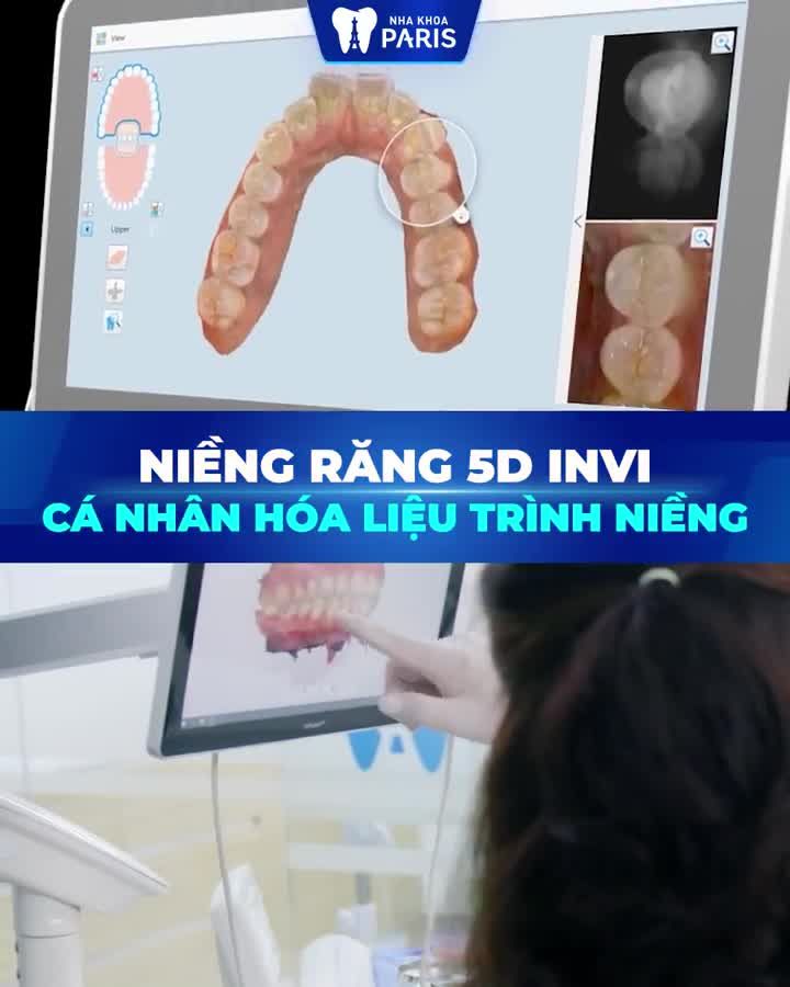 Nâng tầm trải nghiệm niềng Invisalign tại Nha Khoa Paris