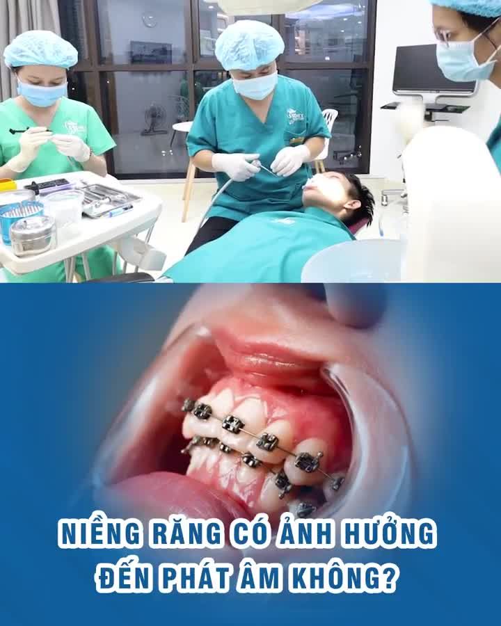 Niềng răng có ảnh hưởng đến phát âm không
