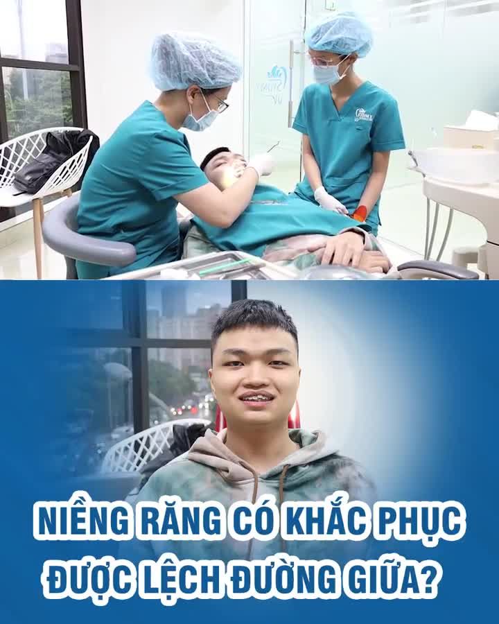 Niềng răng có khắc phục được lệch đường giữa