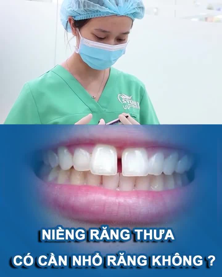 Niềng răng thưa có cần nhổ răng không