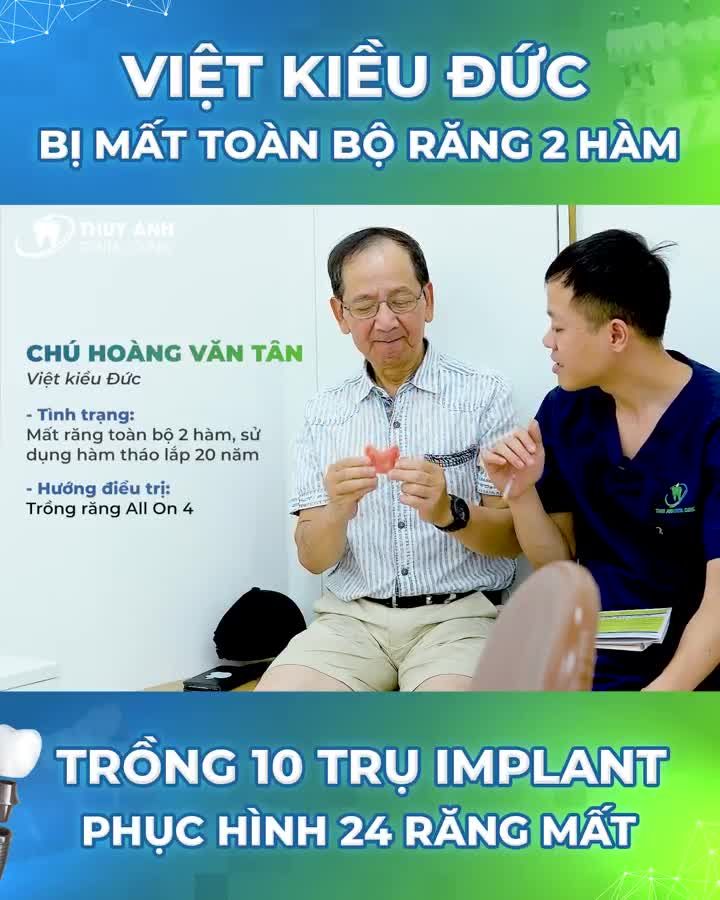 PHỤC HÌNH 24 RĂNG MẤT CHỈ VỚI 10 TRỤ IMPLANT