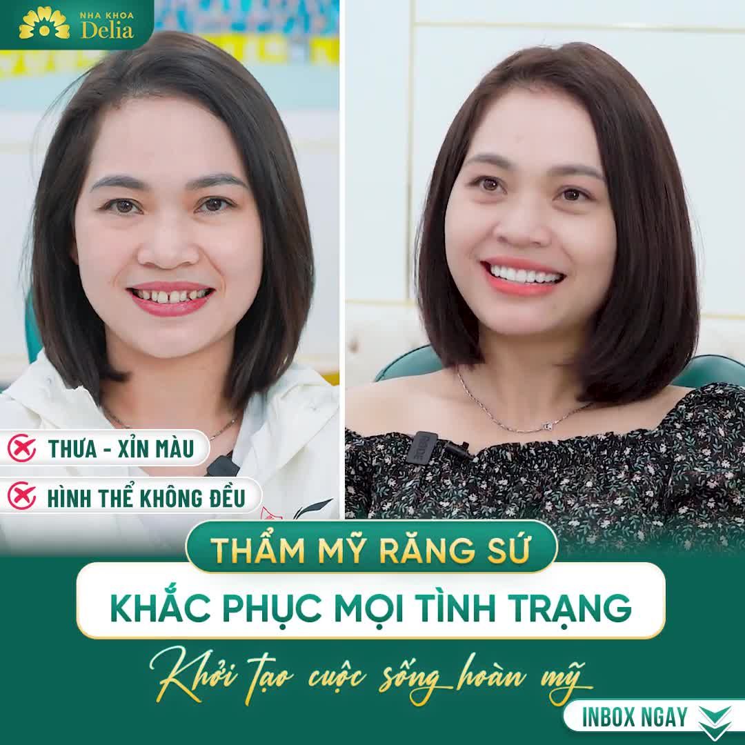 Sau khi làm răng sứ, mình ăn nhai thoải mái. Ai cũng bảo thay đổi ngoạn mục, cười nhiều hơn, tự tin hơn trong cuộc sống.