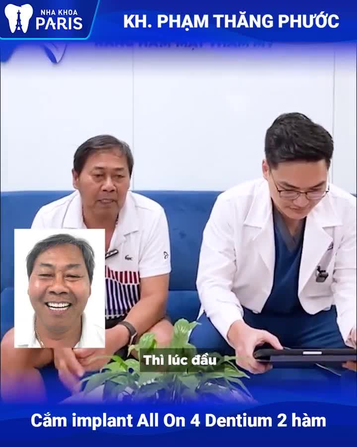 TRỒNG RĂNG IMPLANT TOÀN HÀM TỐT KO