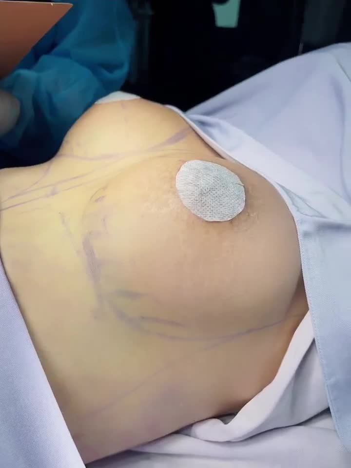 Sau 1 giấc ngủ trưa Có ngực ĐẸP KỊP TẾT và đẹp luôn cả đời!