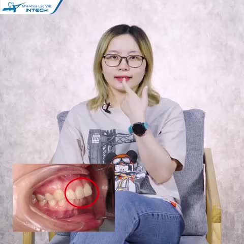 NIỀNG RĂNG HIỆU QUẢ HƠN - NHANH HƠN NHỜ CÔNG NGHỆ X-MATRIX