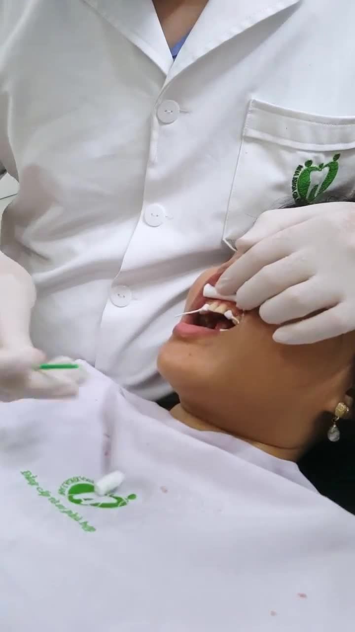 QUÁ TRÌNH DÁN SỨ VENEER CAO CẤP CHO NỮ KHÁCH HÀNG XINH ĐẸP