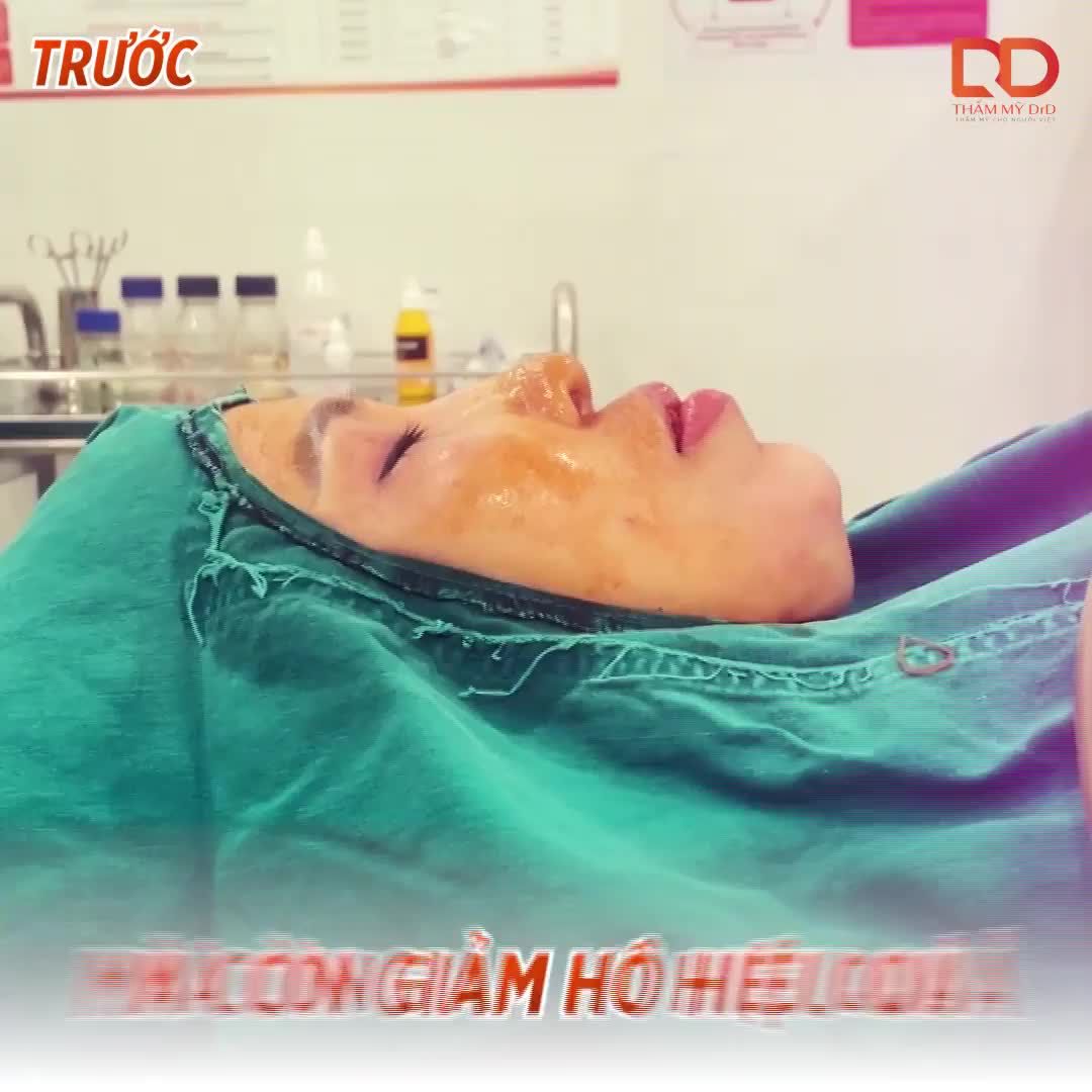 HẾT HÀM HÔ, CÓ NGAY CẰM VLINE SAU 30 PHÚT ĐỘN CẰM