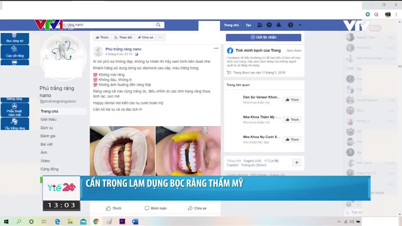 BỌC RĂNG SỨ LỰA CHỌN CƠ SỞ AN TOÀN HAY "TIỀN MẤT, TẬT MANG" VÌ HAM RẺ?