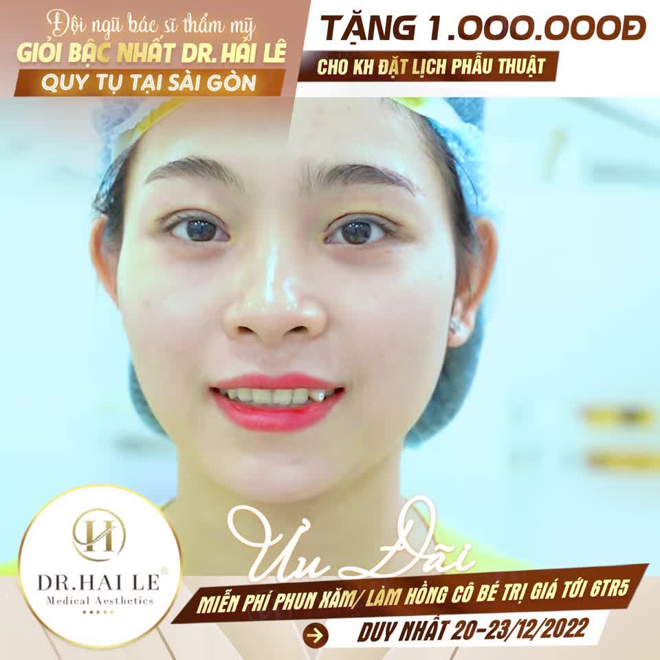 Mắt đẹp - mí xinh lung linh đón Tết
