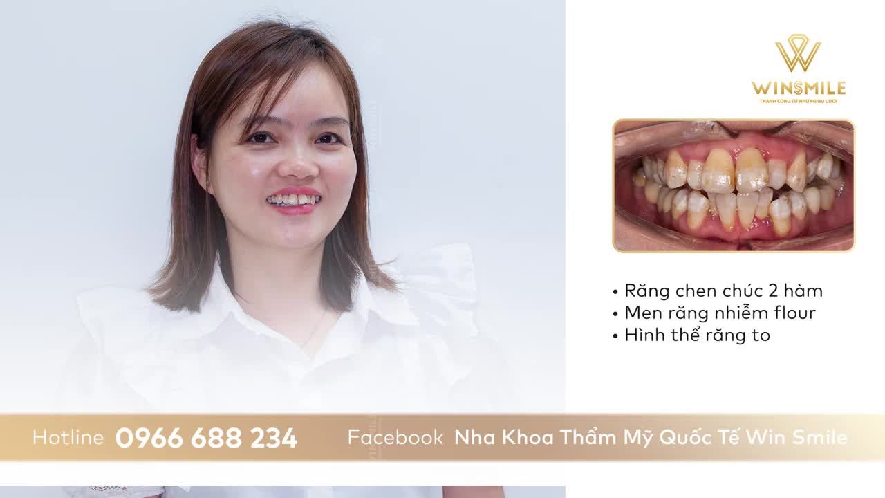 Phá bỏ lời nguyền "Chụp ảnh không bao giờ đẹp" nhờ nụ cười mới tại Win Smile
