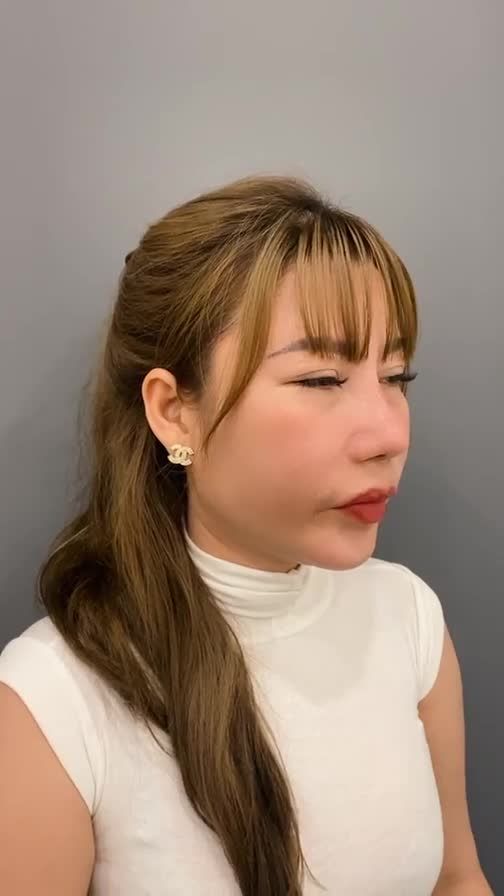 TRÀN FILLER SAU THỜI GIAN DÀI SỬ DỤNG VÀ PHẢI ĐẾN TRUNG TÂM BÁC SĨ KHẢI ĐỂ NÂNG MŨI, XỬ LÝ FILER DƯ