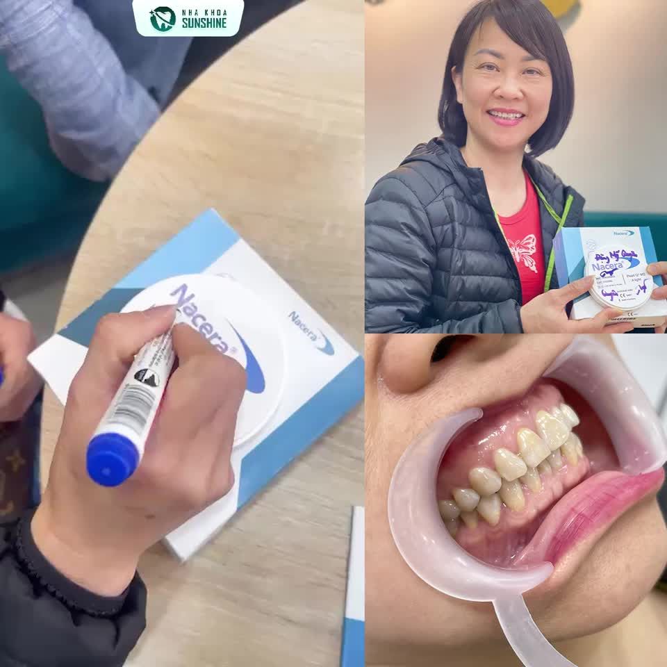 KHÁCH HÀNG ĐẶNG MỸ DUNG KÍ PHÔI SỨ 20 RĂNG #NACERA_Q3