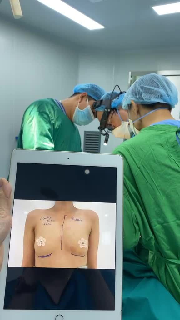 Phân tích tình hình trước khi khách hàng nâng ngực