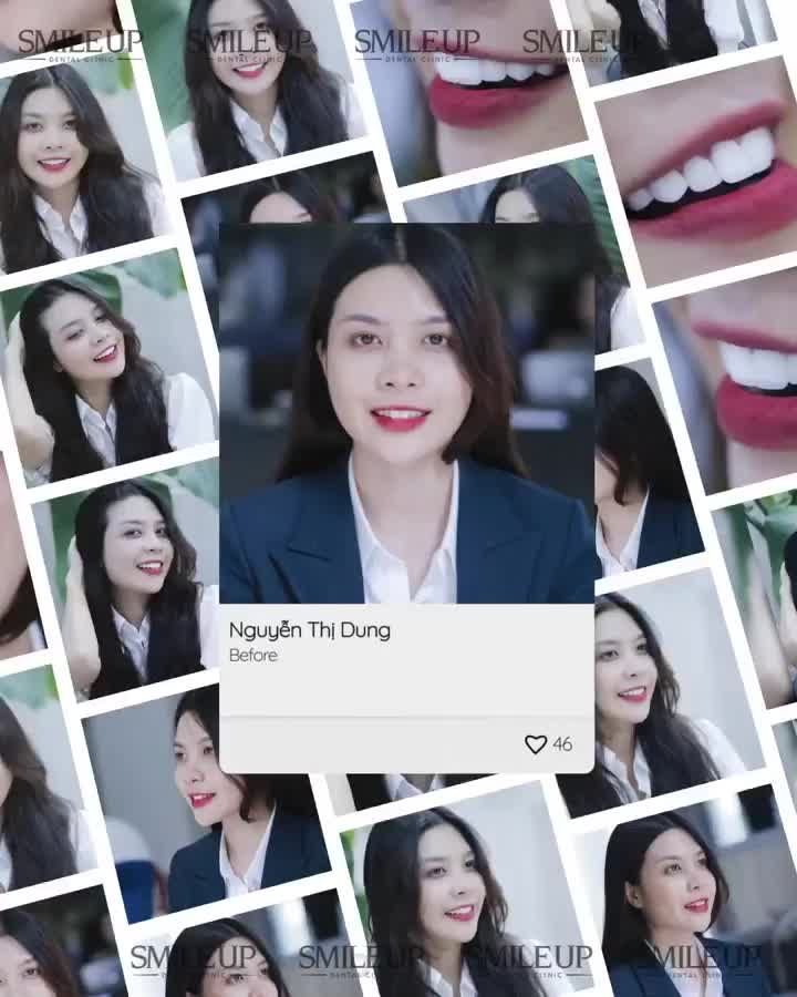 Một gương mặt xinh đẹp sẽ càng trở nên nổi bật hơn với một nụ cười trắng sáng rạng rỡ