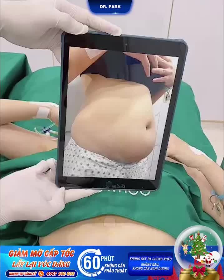 SỰ THẬT VỀ CÔNG NGHỆ HÚT MỠ LIPO ULTRASOUND