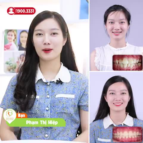 MANG BẦU CÓ NIỀNG RĂNG ĐƯỢC KHÔNG?