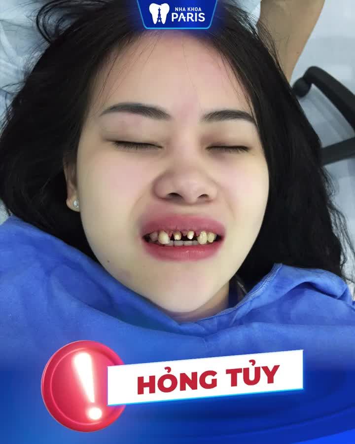 Muốn ăn Tết ngon - Chọn Chuyên Gia Uy Tín
