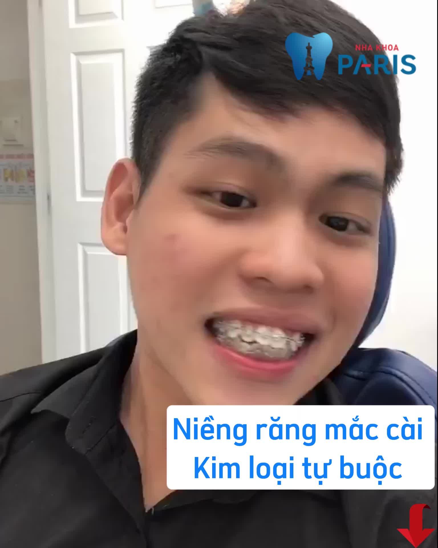 SẮP TẾT RỒI! ĐI NIỀNG RĂNG THÔI!