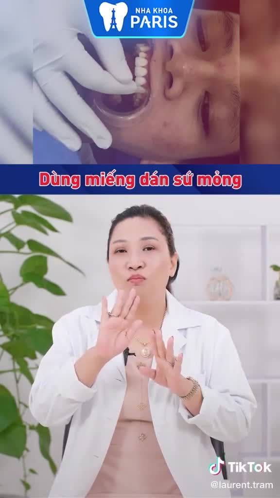 DÁN SỨ VENEER SIÊU MỎNG, SIÊU BỀN, KHÔNG CẦN MÀI RĂNG