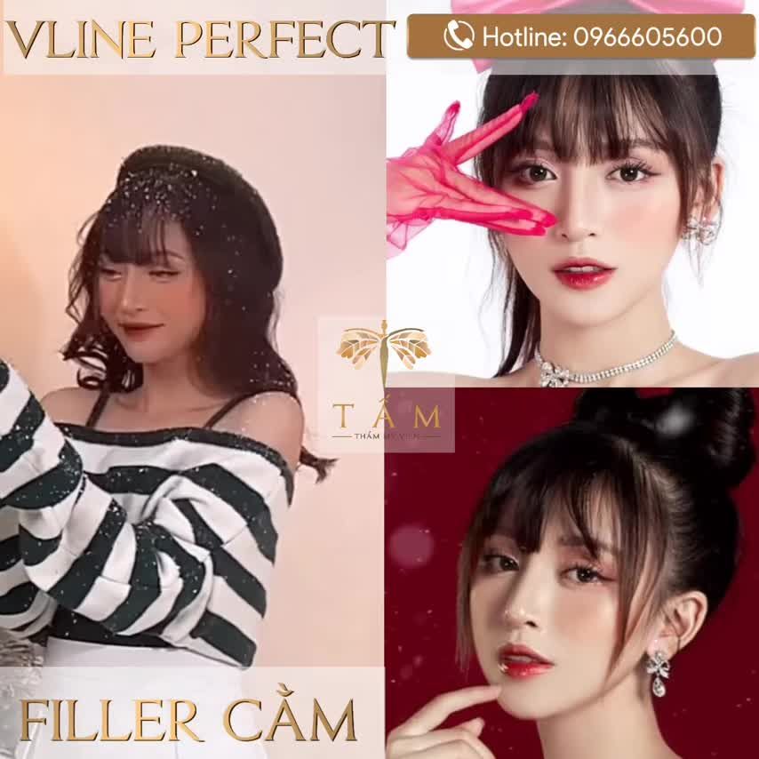 Giáng sinh lung linh nhờ Filler cằm + Vline Perfect tại Tấm.