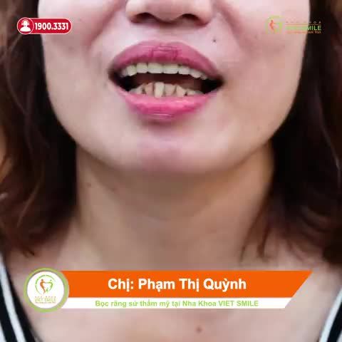 THẨM MỸ RĂNG SỨ LẤY LẠI NỤ CƯỜI ĐẸP TỰ NHIÊN, TỰ TIN GIAO TIẾP