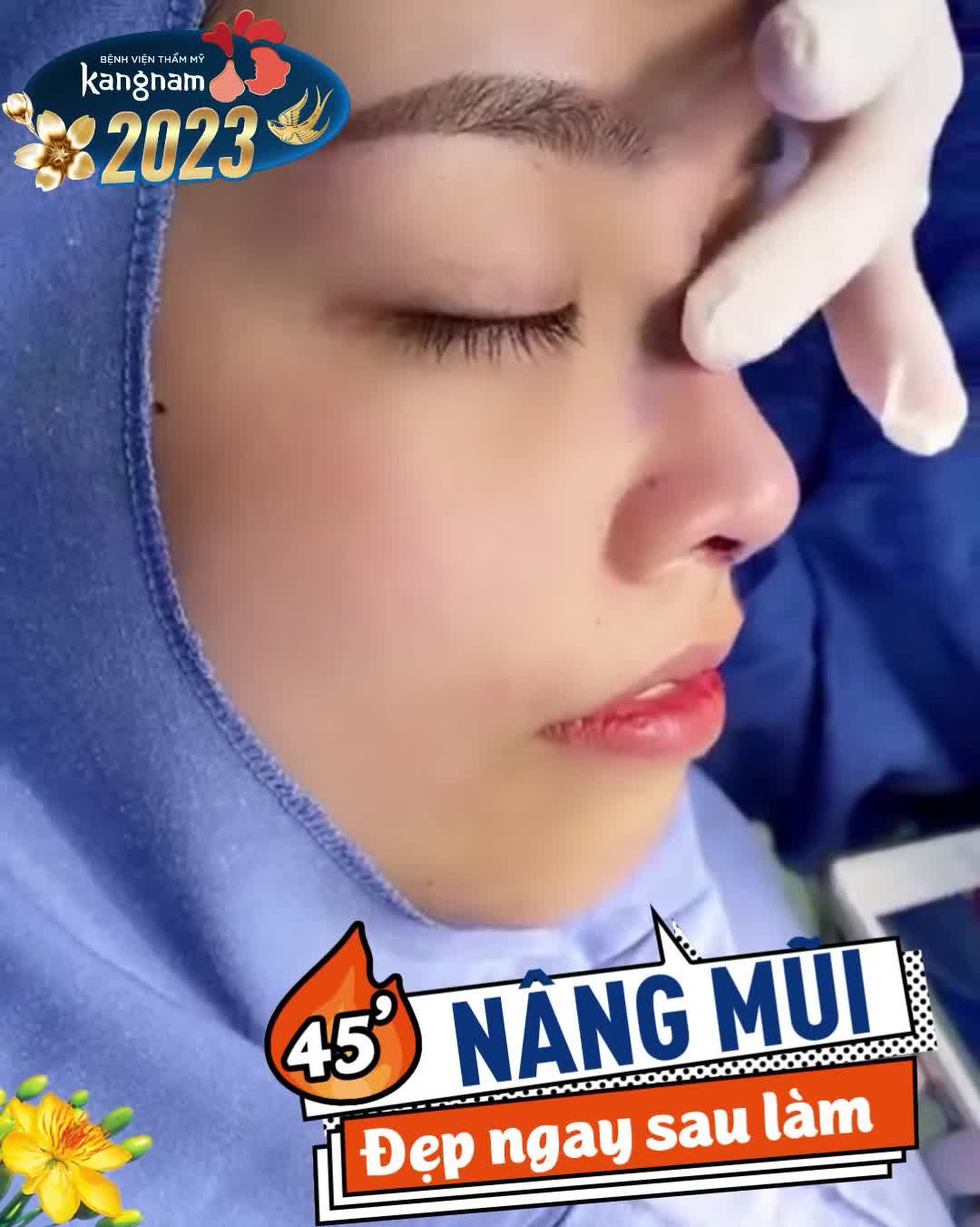 Mê luôn dáng mũi đẹp ngay sau làm