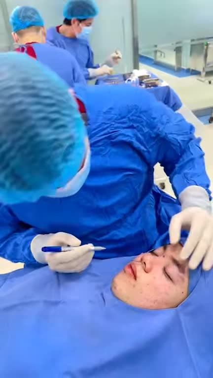 hân tích phẫu thuật Nâng mũi Cấu trúc 4D cho KH nam