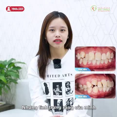 AN TÂM, THOẢI MÁI NIỀNG RĂNG KHÔNG SỤT CÂN, KHÔNG HÓP MÁ