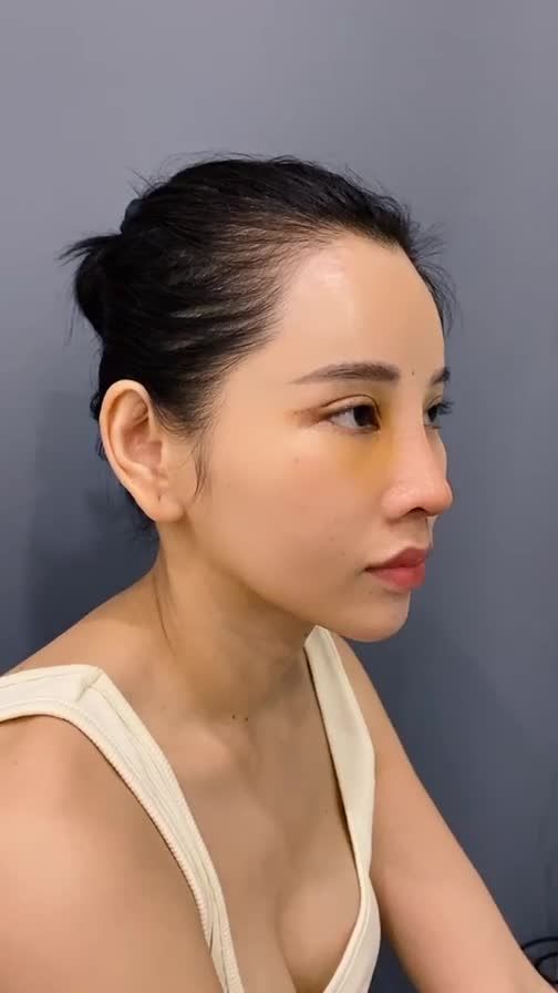 KẾT QUẢ SAU 4 NGÀY VỚI COMBO 5 DỊCH VỤ